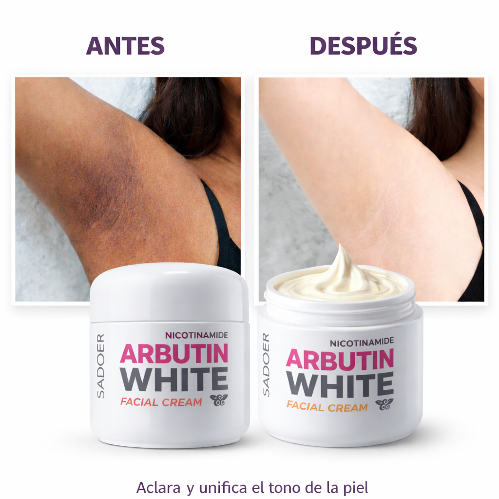 Crema Aclarante Arbutin White con Nicotinamida