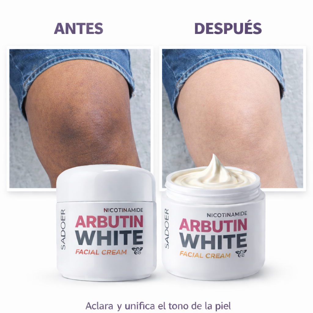 Crema Aclarante Arbutin White con Nicotinamida